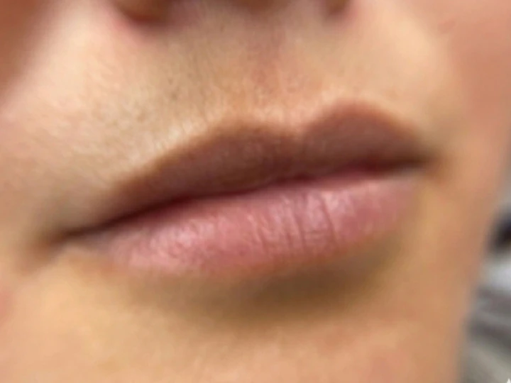 Natural lips before lip blush treatment